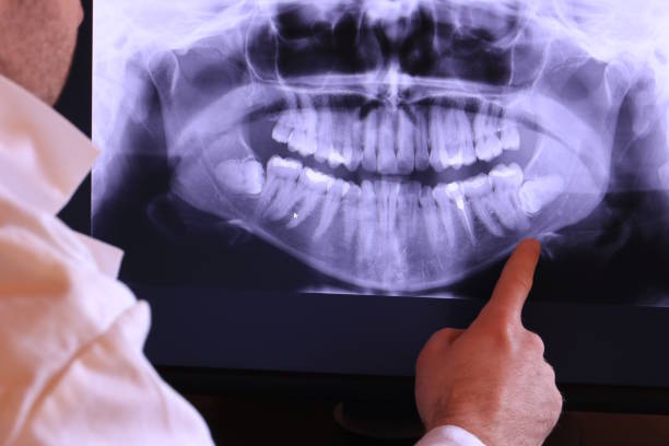 Best Weekend Emergency Dentist in Houghton Lake, MI