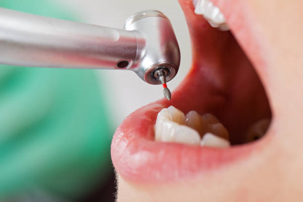 Best Emergency Treatment for Toothache in Houghton Lake, MI